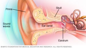 Ear Problems